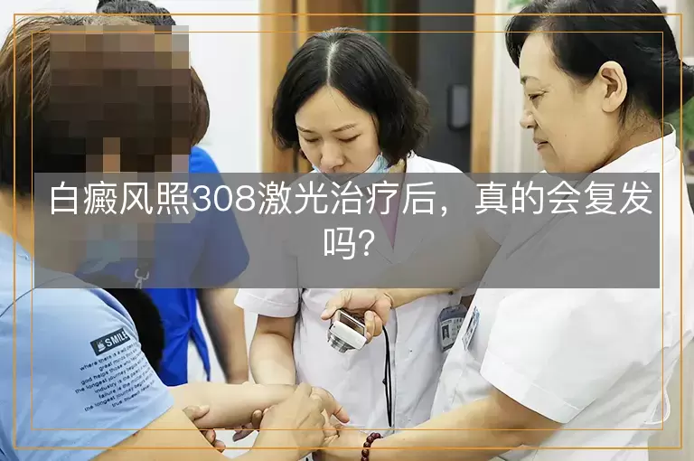 白癜风照308激光治疗后，真的会复发吗？