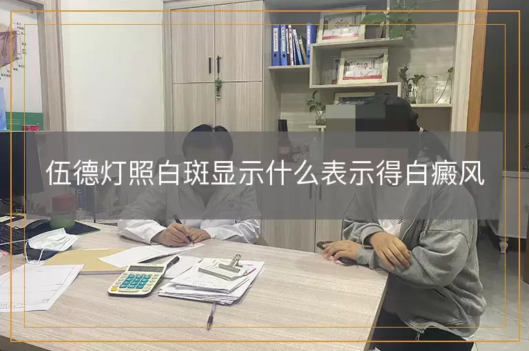 伍德灯照白斑显示什么表示得白癜风