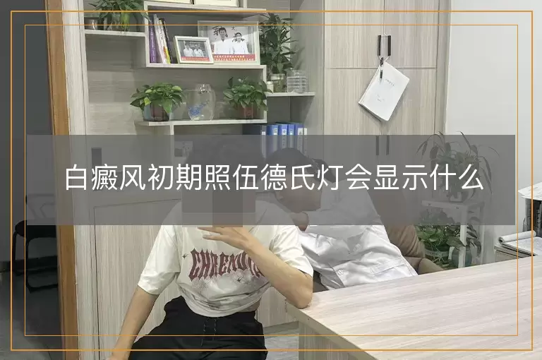 白癜风初期照伍德氏灯会显示什么