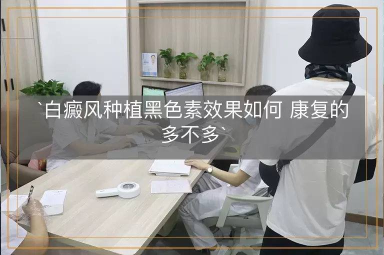 白癜风种植黑色素效果如何 康复的多不多