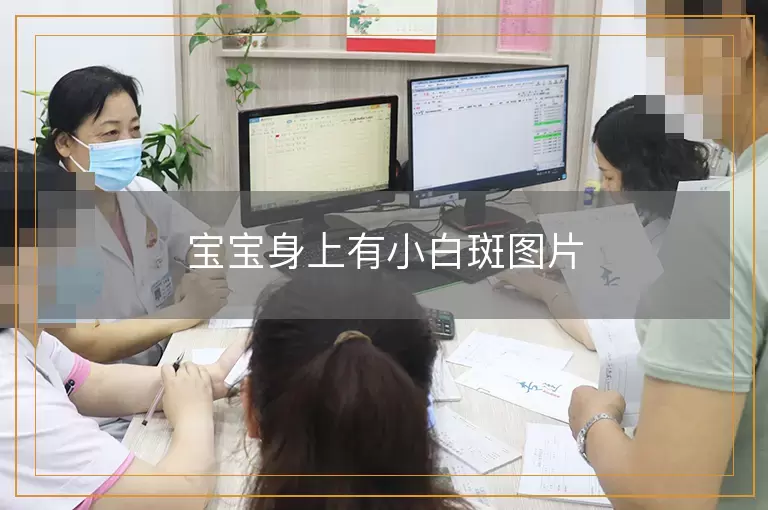 宝宝身上有小白斑图片