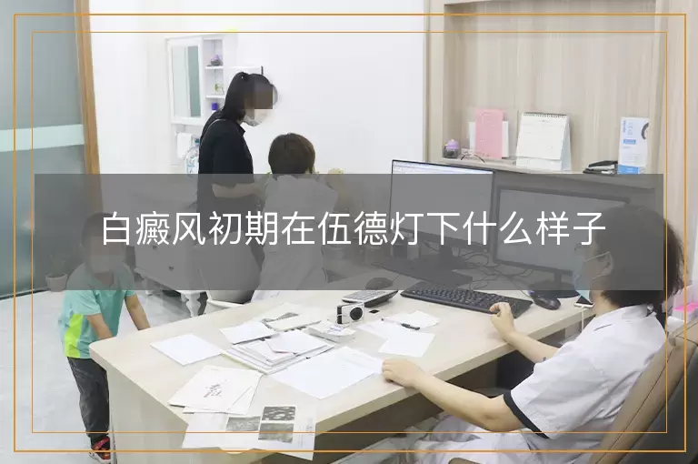 白癜风初期在伍德灯下什么样子