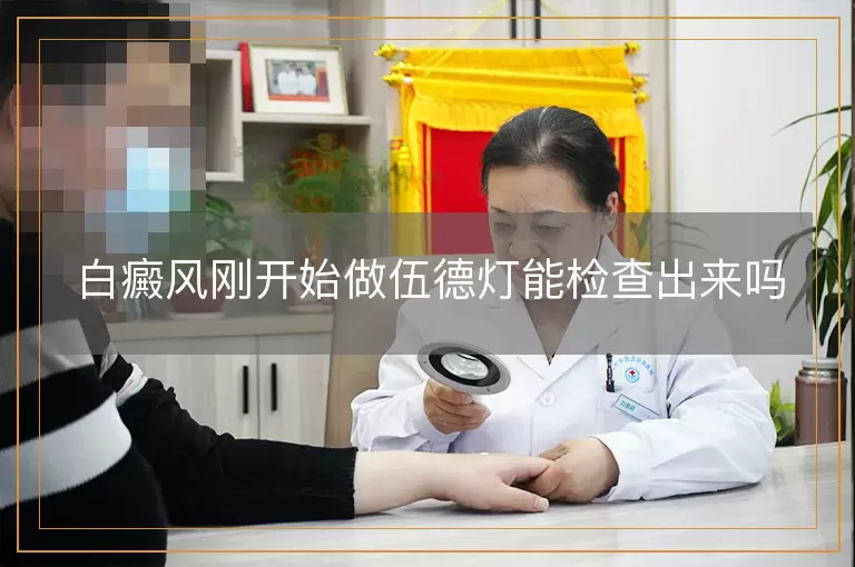 白癜风刚开始做伍德灯能检查出来吗