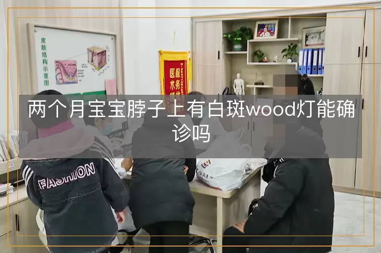 两个月宝宝脖子上有白斑wood灯能确诊吗