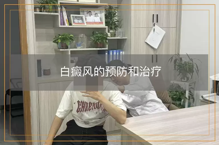 白癜风的预防和治疗