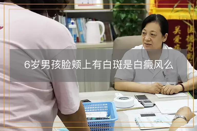 6岁男孩脸颊上有白斑是白癜风么