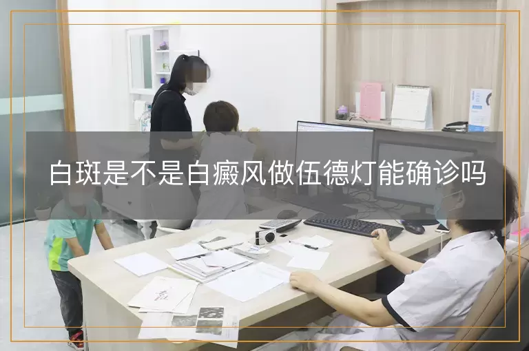 白斑是不是白癜风做伍德灯能确诊吗