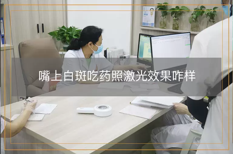 嘴上白斑吃药照激光效果咋样