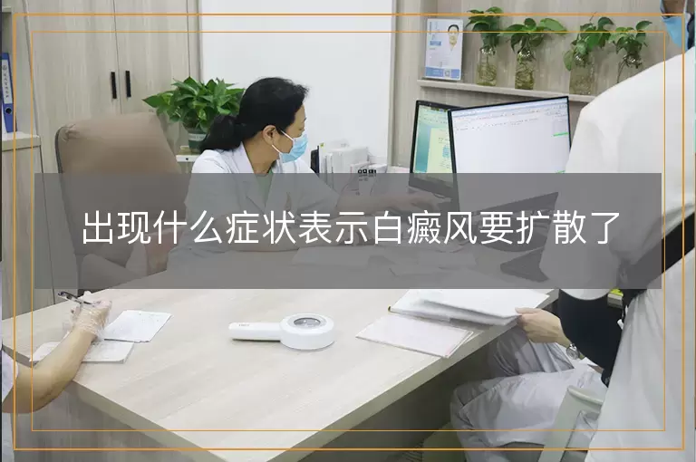 出现什么症状表示白癜风要扩散了