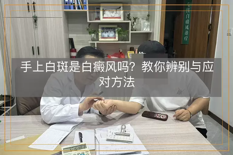 手上白斑是白癜风吗？教你辨别与应对方法