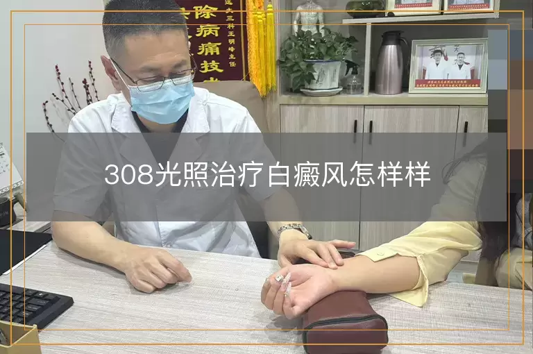 308光照治疗白癜风怎样样