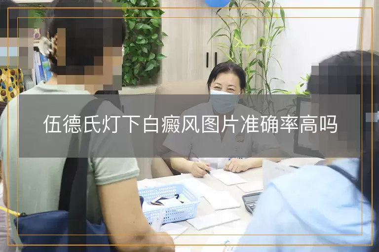 伍德氏灯下白癜风图片准确率高吗