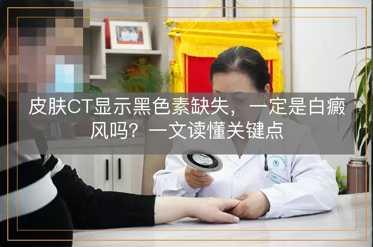 皮肤CT显示黑色素缺失，一定是白癜风吗？一文读懂关键点