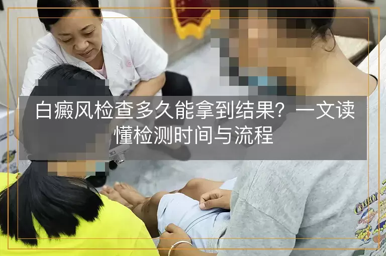 白癜风检查多久能拿到结果？一文读懂检测时间与流程