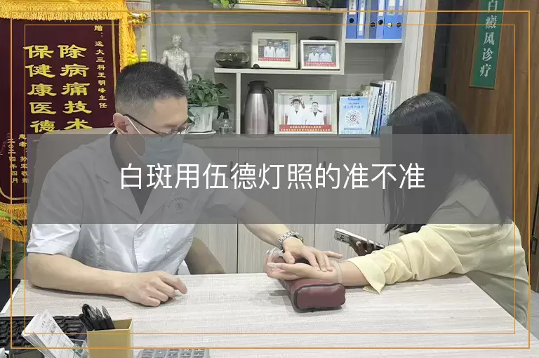 白斑用伍德灯照的准不准