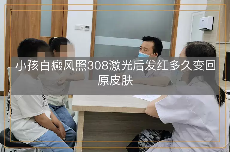 小孩白癜风照308激光后发红多久变回原皮肤