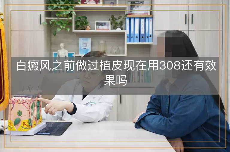 白癜风之前做过植皮现在用308还有效果吗