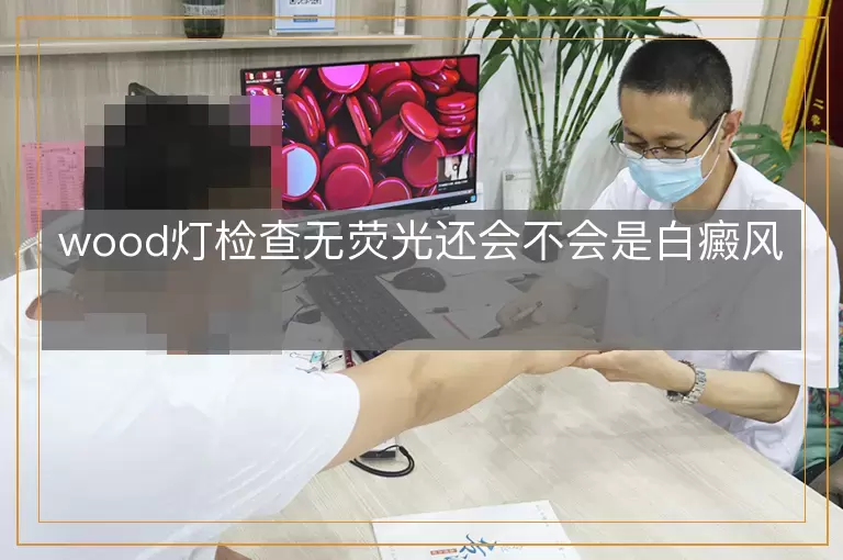 wood灯检查无荧光还会不会是白癜风