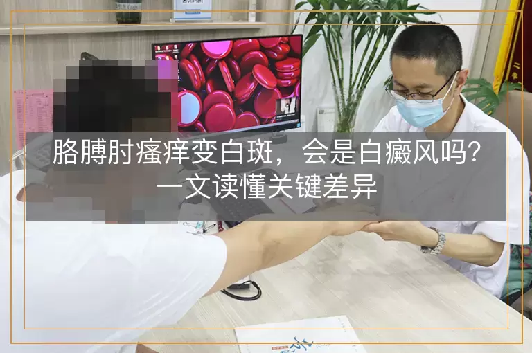 胳膊肘瘙痒变白斑，会是白癜风吗？一文读懂关键差异