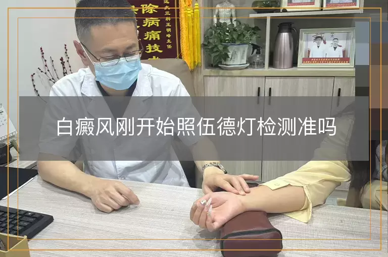 白癜风刚开始照伍德灯检测准吗