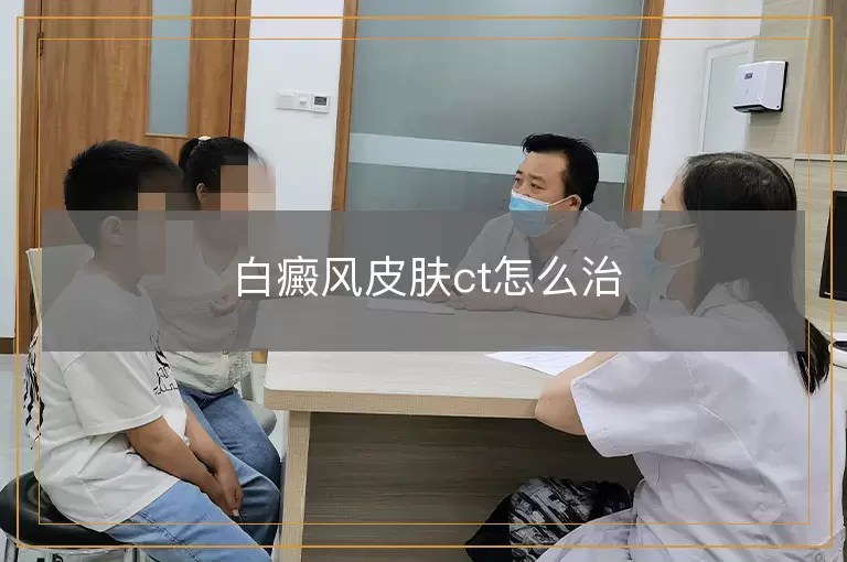 白癜风皮肤ct怎么治