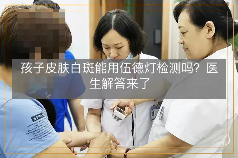 孩子皮肤白斑能用伍德灯检测吗？医生解答来了