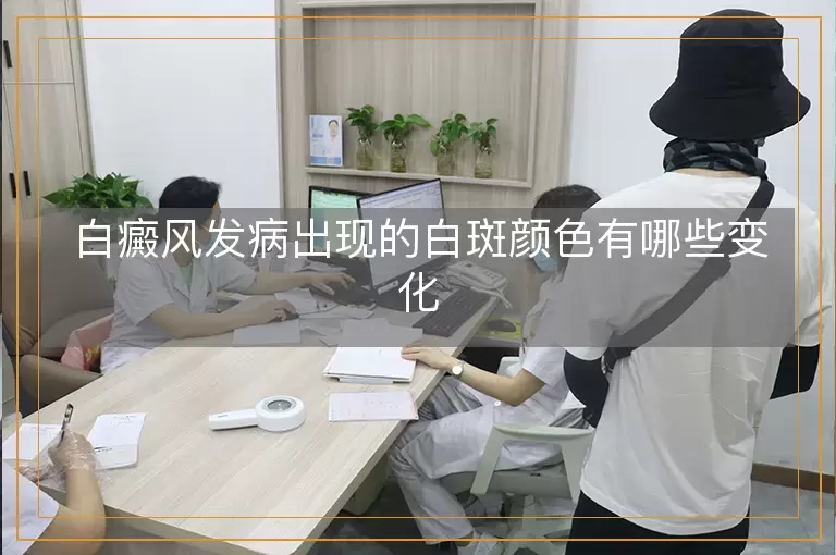 白癜风发病出现的白斑颜色有哪些变化