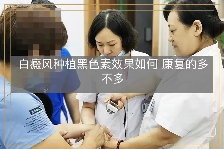 白癜风种植黑色素效果如何 康复的多不多
