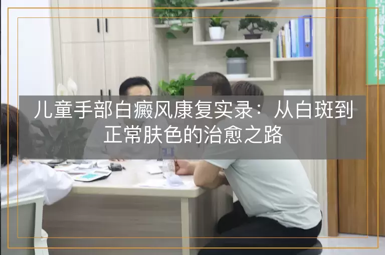 儿童手部白癜风康复实录：从白斑到正常肤色的治愈之路