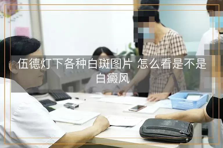伍德灯下各种白斑图片 怎么看是不是白癜风