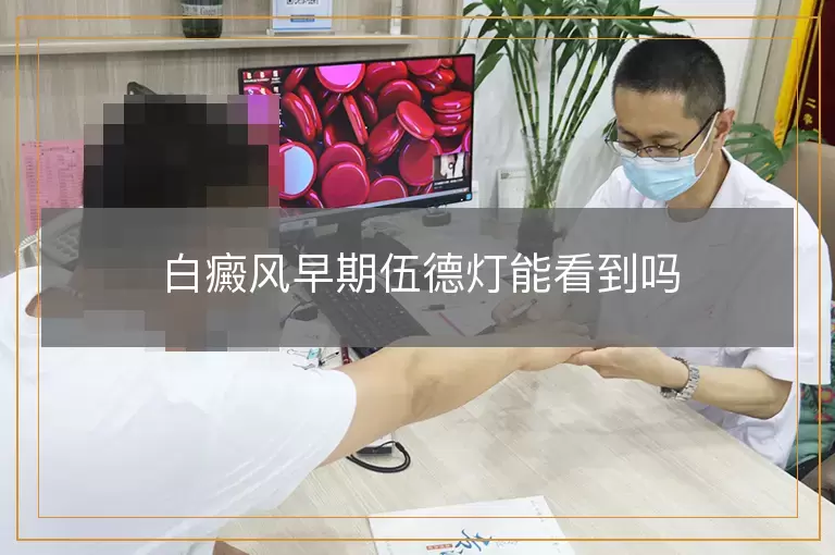 白癜风早期伍德灯能看到吗