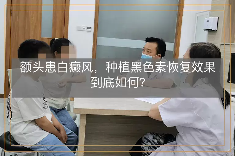 额头患白癜风，种植黑色素恢复效果到底如何？