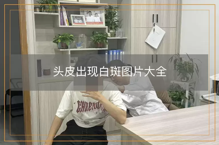 头皮出现白斑图片大全