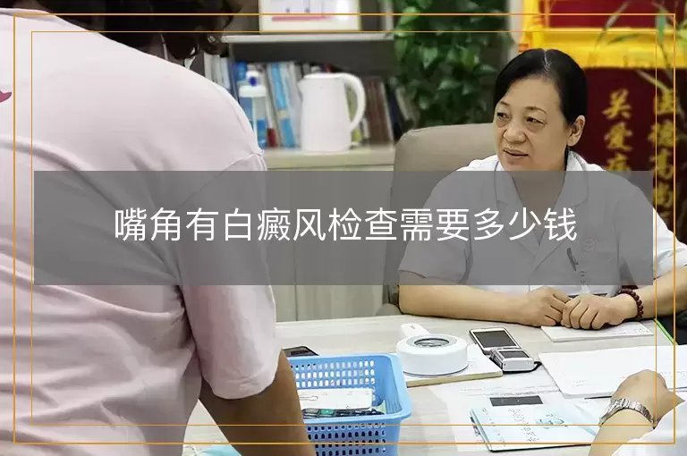 嘴角有白癜风检查需要多少钱