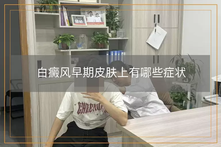 白癜风早期皮肤上有哪些症状
