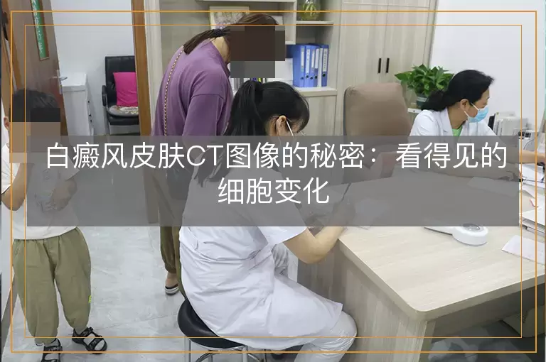 白癜风皮肤CT图像的秘密：看得见的细胞变化