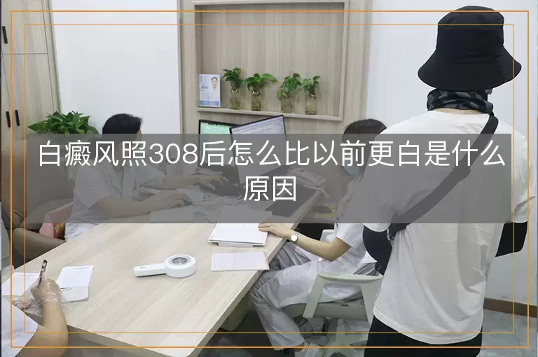 白癜风照308后怎么比以前更白是什么原因
