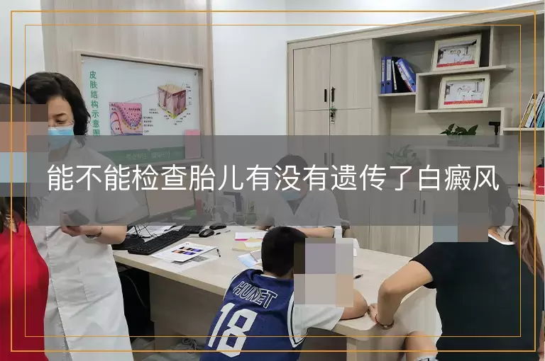 能不能检查胎儿有没有遗传了白癜风
