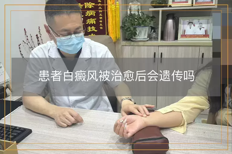 患者白癜风被治愈后会遗传吗