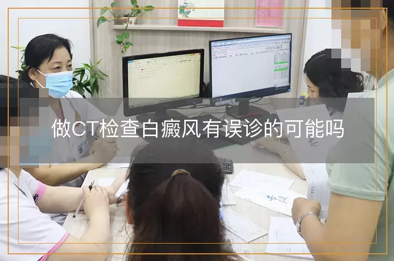 做CT检查白癜风有误诊的可能吗