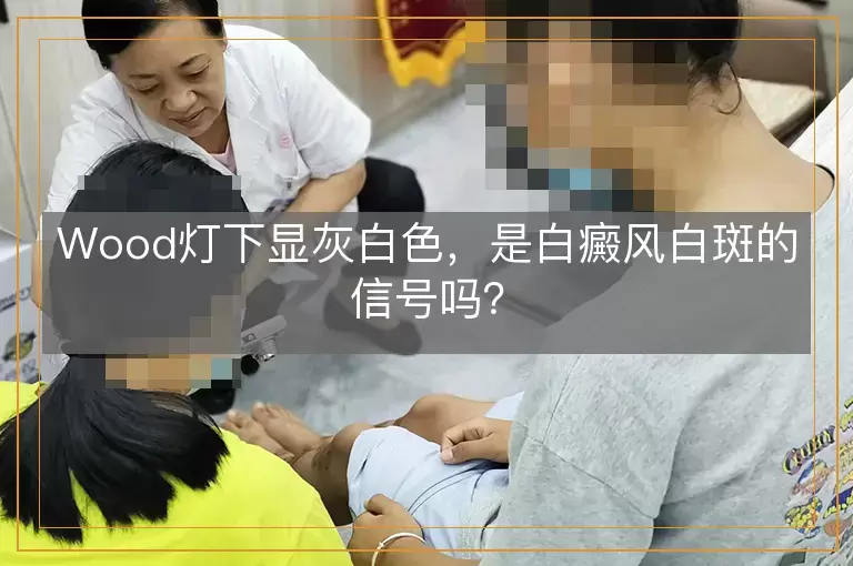 Wood灯下显灰白色，是白癜风白斑的信号吗？