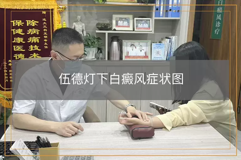 伍德灯下白癜风症状图