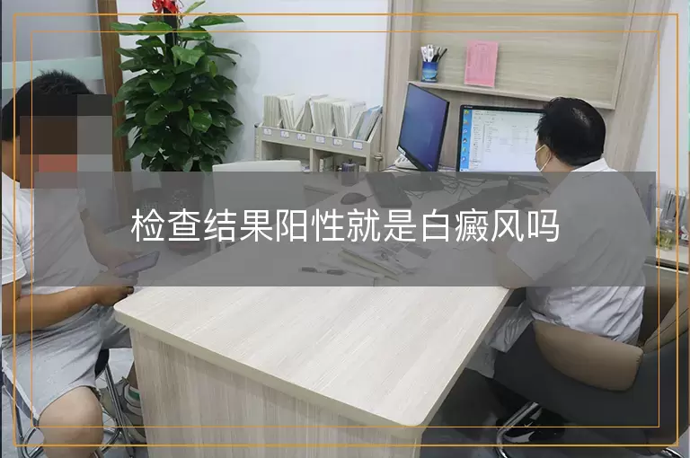检查结果阳性就是白癜风吗