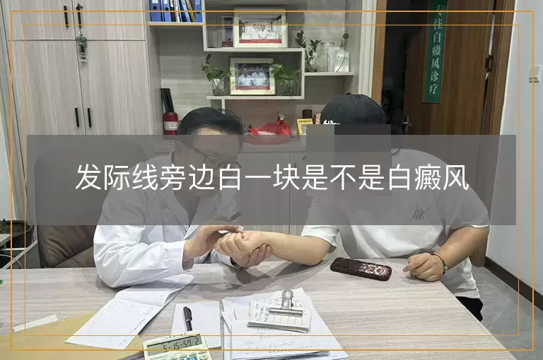 发际线旁边白一块是不是白癜风