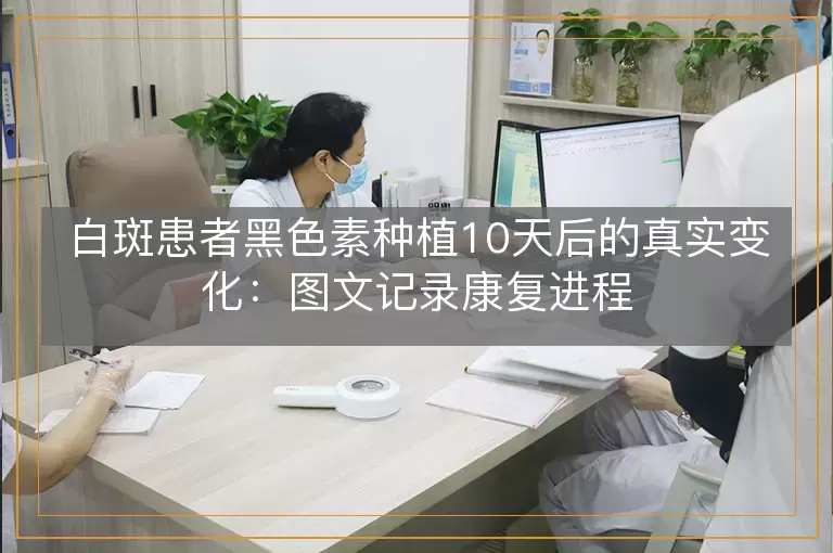 白斑患者黑色素种植10天后的真实变化：图文记录康复进程