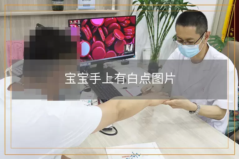 宝宝手上有白点图片