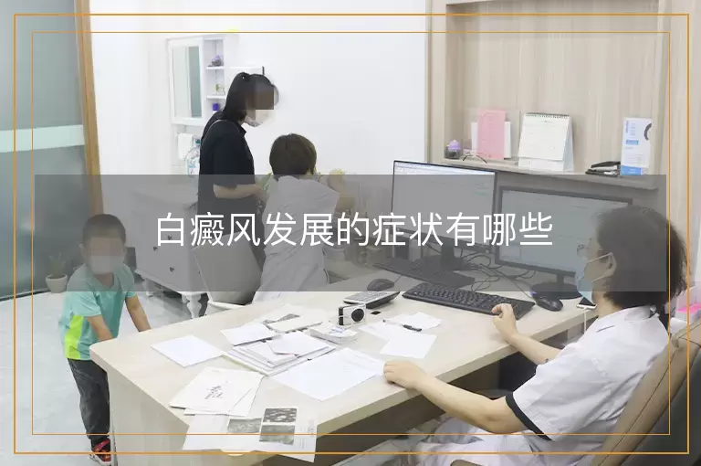 白癜风发展的症状有哪些