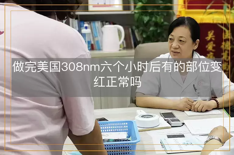做完美国308nm六个小时后有的部位变红正常吗