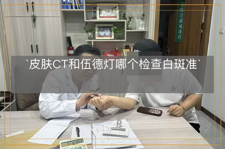 皮肤CT和伍德灯哪个检查白斑准