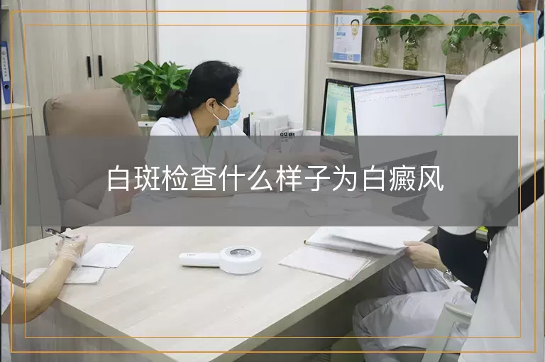 白斑检查什么样子为白癜风